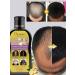 Disaar Anti-Hair Loss Shampoo - Buy Online on GoSupps.com