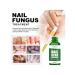 West & Month Nail products from fungus China 30 ml - Buy Online on GoSupps.com