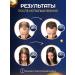 Vikinord Mega-Buster 15% (2 pcs) for hair growth + Mesoroller - Buy Online on GoSupps.com