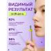 WISTERY Skin cream around the eyes from edema and dark circles 20 ml - Buy Online on GoSupps.com