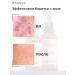 2Doctors Acne cream - Buy Online on GoSupps.com