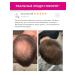 Shampoo from lifting hair with aminexil Aminexil - Buy Online on GoSupps.com