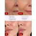 Retinol Anti-Wrinkle Serum - Buy Online on GoSupps.com