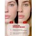 Retinol Anti-Wrinkle Serum - Buy Online on GoSupps.com