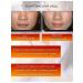 Bor on Akli Whitening face cream body from age spots - Buy Online on GoSupps.com