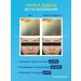 CKD GUARANTEED Hydrogele mask with vitamin C and microeles 3 pcs of Korea - Buy Online on GoSupps.com