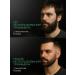 Avets Trimmer for beard and face set with nozzles 10 in 1 - Buy Online on GoSupps.com