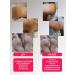 Urea with urea 20% moisturizing - Buy Online on GoSupps.com