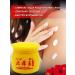 All discounts are here King of the skin cream from psoriasis ointment from acne dermatitis eczema - Buy Online on GoSupps.com