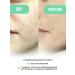 VT Cosmetics Facial anti -aging serum PDRN 100 VT Reedle - Buy Online on GoSupps.com