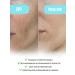 VT Cosmetics Hydrogel mask for skin elasticity with PDRN - Buy Online on GoSupps.com