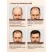 MeMurchu Hair growth activator serum anti-hair loss serum - Buy Online on GoSupps.com