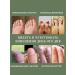 Barynch Remedy for nail fungus on the legs Therapeutic - Buy Online on GoSupps.com
