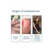Nail repair solution XIMONTH - Buy Online on GoSupps.com