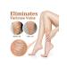 Body scrub from varicose veins (100 ml of exfoliation) - Buy Online on GoSupps.com