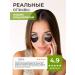 sadoer A set of eye patches from edema and bags with collagen - Buy Online on GoSupps.com