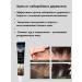 AllenGo Treatment of seborrheic dermatitis and hair loss Cream+soap - Buy Online on GoSupps.com