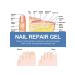 Ouhoe gel to care for nail fungus - Buy Online on GoSupps.com