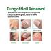 Eelhoe repair of nail fungus Nutrum solution for fungi - Buy Online on GoSupps.com