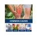 Ximonth joint spray from joint pain - Buy Online on GoSupps.com