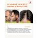 Tokishi P Hair growth with rosemary oil - Buy Online on GoSupps.com
