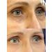 VT Cosmetics Cream around the eyes of Reedle Shot Lifting Eye Cream - Buy Online on GoSupps.com