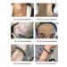 VALLEY Vitiligo cream and Vitiligo hyperpigmentation - Buy Online on GoSupps.com