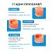 INKI Cream protective agent for the treatment of pressure sores - Buy Online on GoSupps.com