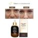 Eshumi Facial serum anti -aging 35ml Korea - Buy Online on GoSupps.com