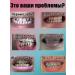 Super bleaching toothpaste teeth whitening agent - Buy Online on GoSupps.com