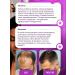 LUCAS PREMIUM LC Hair growth with rosemary activator - Buy Online on GoSupps.com