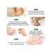 Barynch Nail fungus ointment antifungol with nail fungus onycholysis - Buy Online on GoSupps.com