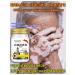 Vitiligo cream of white skin spots
