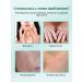 Vitiligo cream of white skin spots - Buy Online on GoSupps.com
