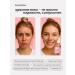 LoveToGlow Facial serum from acne and acne - Buy Online on GoSupps.com
