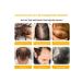 Biotin Oil for Hair Care Deep Moisturizing - Buy Online on GoSupps.com