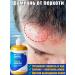 Shampoo for quickly eliminating itching and dandruff