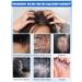 Shampoo for quickly eliminating itching and dandruff - Buy Online on GoSupps.com