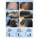 Shampoo for quickly eliminating itching and dandruff - Buy Online on GoSupps.com