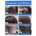 Shampoo for quickly eliminating itching and dandruff - Buy Online on GoSupps.com