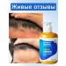 Shampoo for quickly eliminating itching and dandruff - Buy Online on GoSupps.com