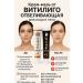 Tissuespam Chinese miracle ointment from vitiligo on the face day night