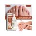 Wheezer to care for nails2 pcs