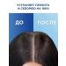 Bioxcin BOOKSIN THEMAL Hair Shampoo Against Dandruff and Seborea - Buy Online on GoSupps.com