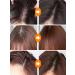 Dodoyuri intense shampoo against dandruff 300 ml - Buy Online on GoSupps.com
