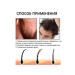 eastmoon Men Hair growth Repair hair follicles Care Essence - Buy Online on GoSupps.com