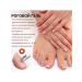 Nail fungus of the horn layer repair thickening moisturizes the gel - Buy Online on GoSupps.com