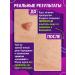 GLS Wellness Center 1+1 Innoskin Clareol Gel-Exfoliant from papillomas and warts - Buy Online on GoSupps.com