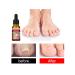 10ml Essence for ingrown nails male female - Buy Online on GoSupps.com
