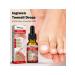 10ml Essence for ingrown nails male female - Buy Online on GoSupps.com